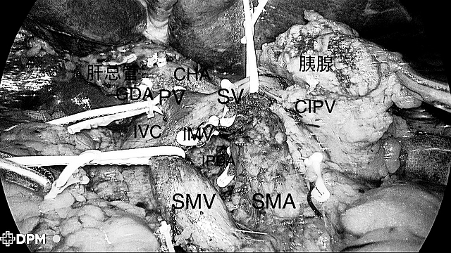 这些症状很常见,一查竟是癌……(图6) nEO_IMG_6.jpg